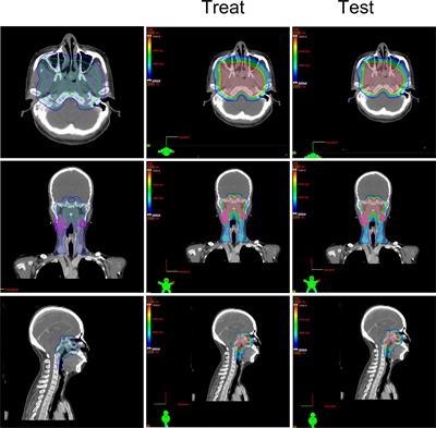 Is a high-risk clinical target volume required? Evaluation of the dosimetric feasibility based on T staging